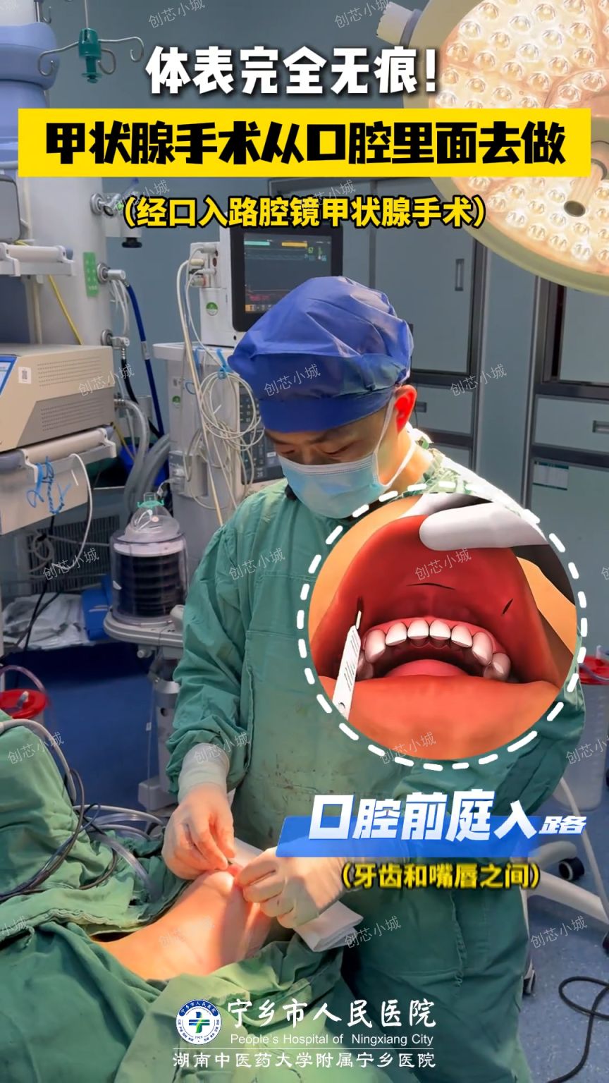 治“甲”无痕，守护“天鹅颈”！这类甲状腺手术让健康美丽两不误